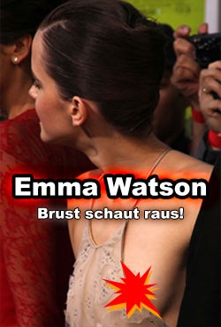 Watson nippel emma Emma Watson